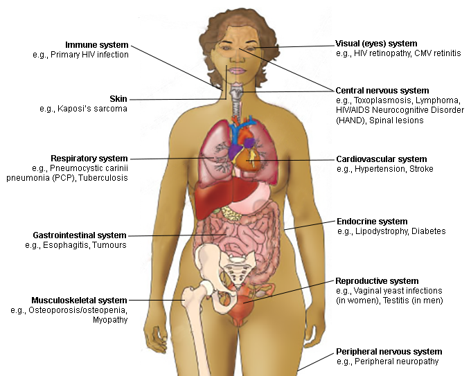 Examples of diagnoses affecting different body systems